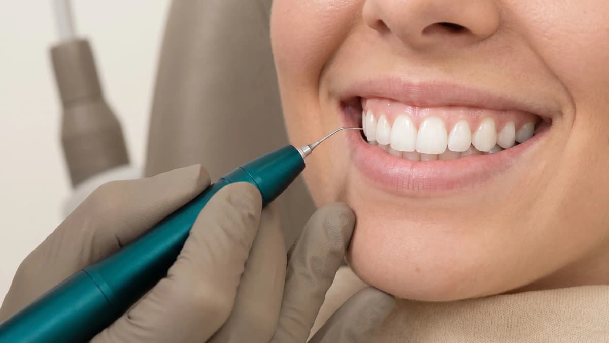 Gingivoplastia con láser para corregir sonrisa gingival